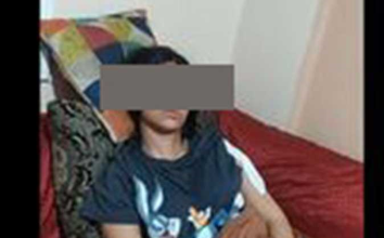 فتاه المول علشان عاتبتها شوهت جسدى ب71 غرزه