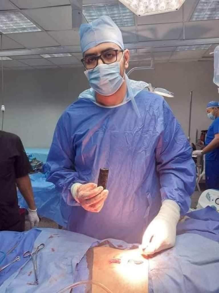 استخراج هاتف محمول من بطن شاب 25 عاما، كان يعاني من آلام شديدة بالبطن والمعدة