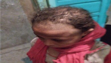 توفت والدتها فقام والدها وزوجته الجديده بتعذيب اليتيمه ندى