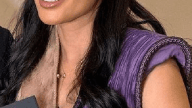 إصابة الفنانه منى زكي بـ كسر في يدها اليسرى