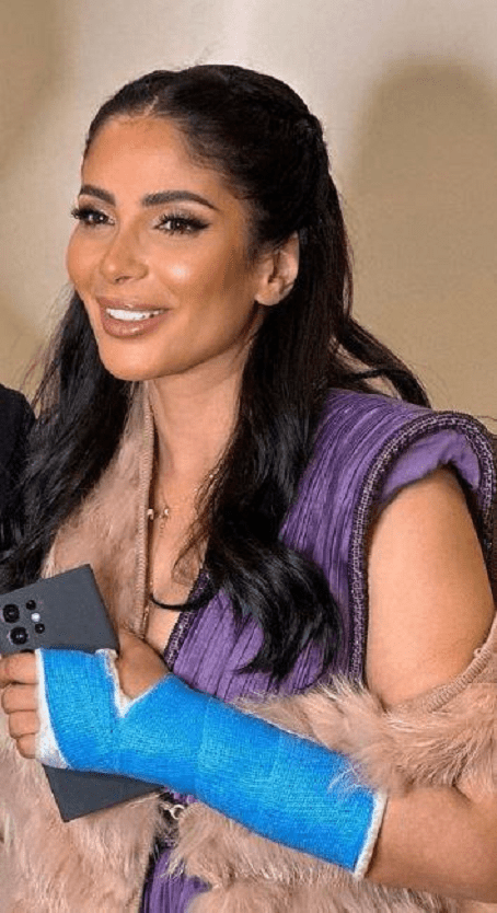 إصابة الفنانه منى زكي بـ كسر في يدها اليسرى