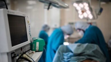 روسيا:رجل يعيش 6 سنوات مع فك اصطناعي في معدته